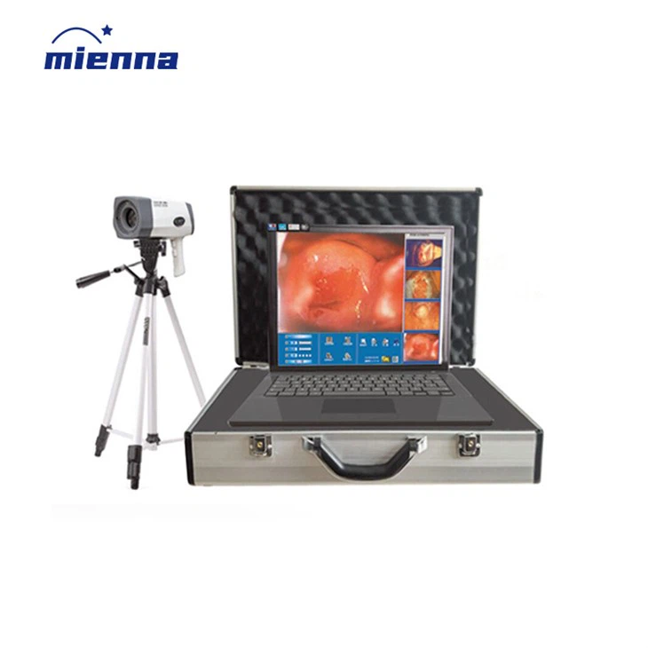 کولپوسکوپی دیجیتال الکترونیکی جراحی زنان و زایمان